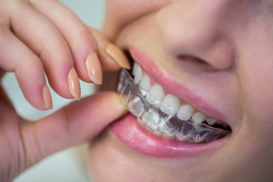 Ortodontia Invisível - Orthoped Odontologia Especializada, Dentista  Brasília